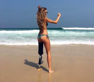 Πανέμορφο μοντέλο δίνει μαθήματα ζωής: Έχασε το πόδι της αλλά ζει μέσα στην περιπέτεια (ΕΙΚΟΝΕΣ)