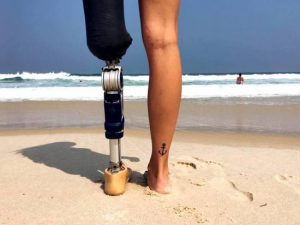 Πανέμορφο μοντέλο δίνει μαθήματα ζωής: Έχασε το πόδι της αλλά ζει μέσα στην περιπέτεια (ΕΙΚΟΝΕΣ)