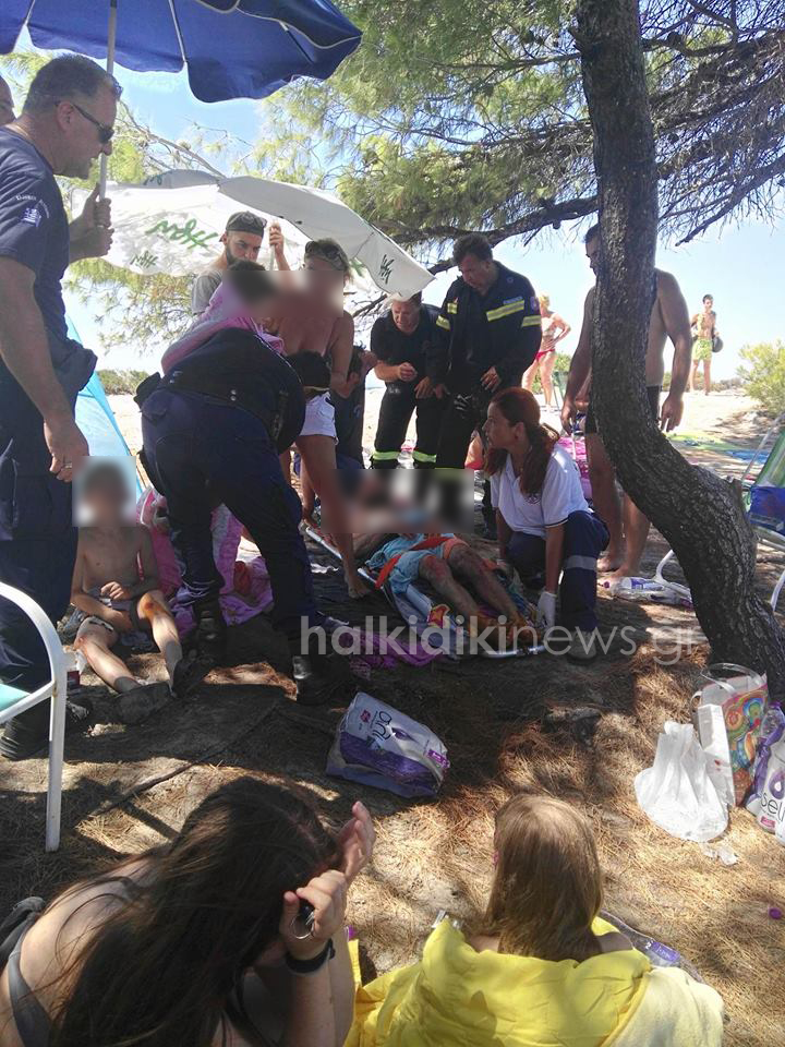 Χαλκιδική: Τραυματίστηκε οικογένεια – Έσκασε γκαζάκι μέσα στη σκηνή - Σε σοβαρή κατάσταση ο πατέρας!