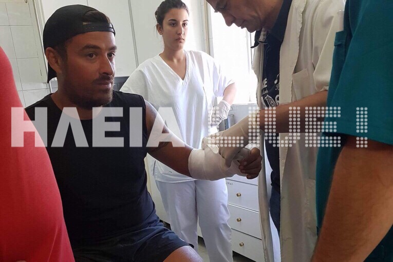 Στο νοσοκομείο της Αμαλιάδας ο Γιάννης Αϊβάζης μετά τον καβγά στο Survival (εικόνες)